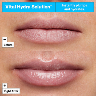 Masque hydratant pour les lèvres Dr. Jart+ Vital Hydra Solution™ 20ml – soin nourrissant et repulpant à l’acide hyaluronique