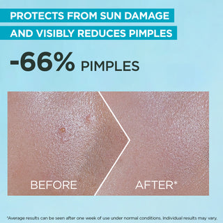 Garnier Super UV Serum Sunscreen SPF50+ PA++++ – Peaux à Imperfections & Anti-Acné