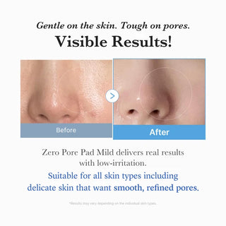 MEDICUBE Zero Pore Pad Mild 70 pads 155 g pores visage K-Beauty BeautyMarket parapharmacie Maroc