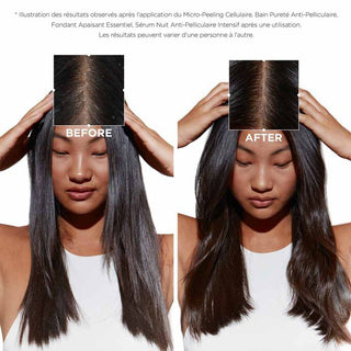 Kérastase Symbiose Bain Pureté Anti-Pelliculaire 250ml – Shampooing Cuir Chevelu Sensible