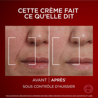 L'ORÉAL PARIS REVITALIFT LASER CREME JOUR 50ML