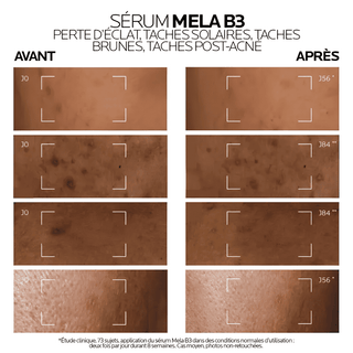 La roche-posay routine anti-taches mela b3 gel micro-peeling 200ml + sérum concentré mela b3 50ml = mini mela b3 10ml + hyalu b5 10ml + trousse offerts