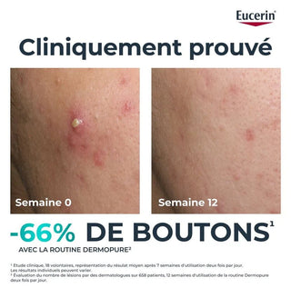 Eucerin Dermopure Clinical sérum triple action 40ml