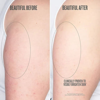 Sol de Janeiro Bom Dia Crème Corps 75 ml, comparaison visuelle avant après