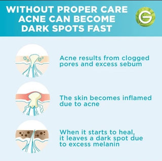GARNIER FAST CLEAR SERUM ANTI ACNE 15ML