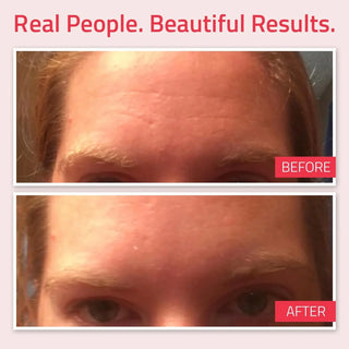 YEOUTH Retinol Serum 30 ML
