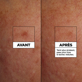 Garnier Fast Bright Serum Cleanser Vitamin C - 100ml