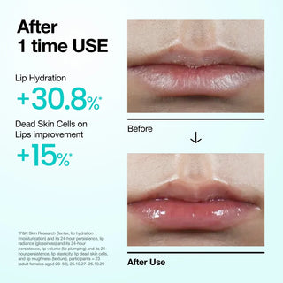 Anua PDRN Hyaluron Lip Serum 10 ml