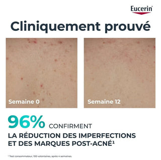 Eucerin dermopurifyer triple effect body cream 200ml