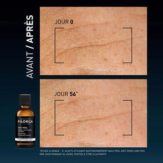 Filorga DAILY PEEL Anti-Rides Solution Resurfaçante Anti-Rides 50ml