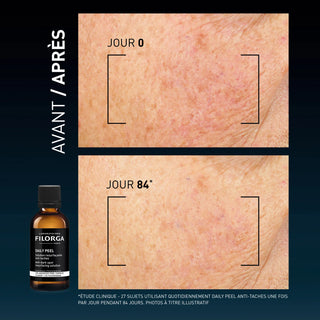 Filorga DAILY PEEL Anti-Taches Solution Resurfaçante Anti-Taches 50ml